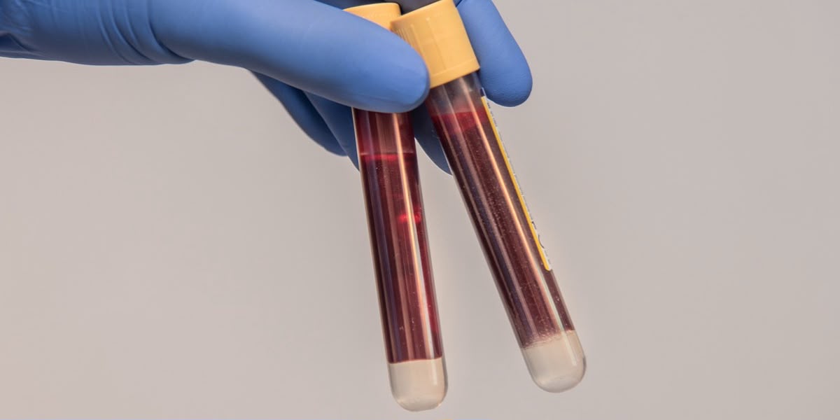IV Therapy y Oligoelementos